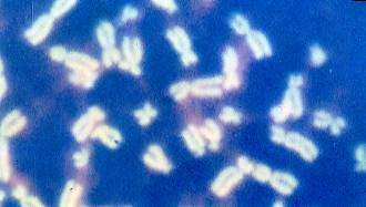  Cromosomi 